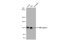 Anti-DNA ligase I antibody [10H5] used in Western Blot (WB). GTX70141