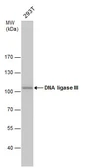 Anti-DNA ligase III antibody [1F3] used in Western Blot (WB). GTX70143