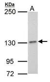 Anti-DNA polymerase delta antibody [607] used in Western Blot (WB). GTX70152