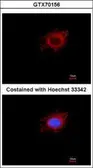 Anti-mtPAP antibody [1D3] used in Immunocytochemistry/ Immunofluorescence (ICC/IF). GTX70156