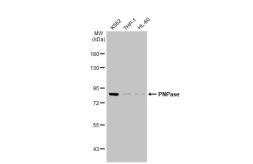 Anti-PNPase antibody [4C11] used in Western Blot (WB). GTX70159