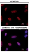 Anti-E2F1 antibody [10D1 2B5] used in Immunocytochemistry/ Immunofluorescence (ICC/IF). GTX70161