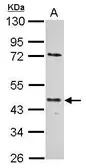 Anti-E2F1 antibody [18E10] used in Western Blot (WB). GTX70165