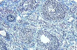 Anti-E2F1 antibody [18E10] used in IHC (Paraffin sections) (IHC-P). GTX70165