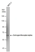 Anti-Estrogen Receptor alpha antibody [1F3] used in Western Blot (WB). GTX70171