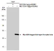 Anti-Estrogen Receptor beta antibody [14C8] used in Western Blot (WB). GTX70174