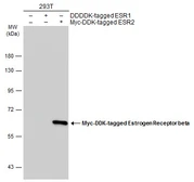 Anti-Estrogen Receptor beta antibody [14C8] used in Western Blot (WB). GTX70174