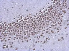 Anti-Estrogen Receptor beta antibody [4D2] used in IHC (Paraffin sections) (IHC-P). GTX70176