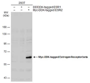 Anti-Estrogen Receptor beta antibody [6B12] used in Western Blot (WB). GTX70180