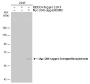 Anti-Estrogen Receptor beta antibody [7B10.7] used in Western Blot (WB). GTX70182