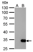 Anti-GST tag antibody [3G10] used in Western Blot (WB). GTX70195