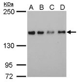 Anti-SAFB antibody [6F7] used in Western Blot (WB). GTX70197