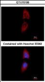 Anti-PNPase antibody [3H5] used in Immunocytochemistry/ Immunofluorescence (ICC/IF). GTX70199