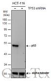 Anti-p53 antibody [DO1] used in Western Blot (WB). GTX70214