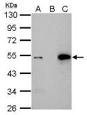 Anti-p53 antibody [Pab1801] used in Immunoprecipitation (IP). GTX70216