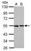 Anti-p53 antibody [Pab240] used in Western Blot (WB). GTX70218