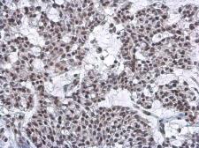 Anti-Nuclear Matrix Protein p84 antibody [5E10] used in IHC (Paraffin sections) (IHC-P). GTX70220