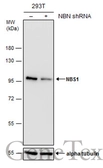 Anti-NBS1 antibody [1C3] used in Western Blot (WB). GTX70222