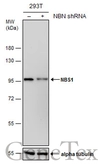 Anti-NBS1 antibody [1D7] used in Western Blot (WB). GTX70224