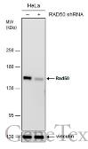 Anti-Rad50 antibody [13B3] used in Western Blot (WB). GTX70228