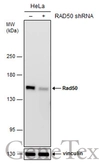 Anti-Rad50 antibody [13B3] used in Western Blot (WB). GTX70228
