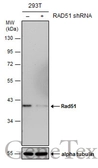 Anti-Rad51 antibody [14B4] used in Western Blot (WB). GTX70230