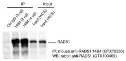 Anti-Rad51 antibody [14B4] used in Immunoprecipitation (IP). GTX70230