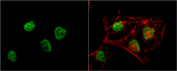 Anti-RbAp48 antibody [13D10] used in Immunocytochemistry/ Immunofluorescence (ICC/IF). GTX70234