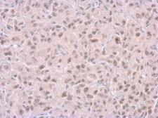 Anti-RPA14 antibody [11.1] used in IHC (Paraffin sections) (IHC-P). GTX70238