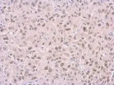Anti-RPA14 antibody [11.1] used in IHC (Paraffin sections) (IHC-P). GTX70238