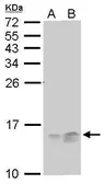 Anti-RPA14 antibody [11.1] used in Western Blot (WB). GTX70238