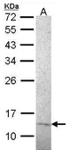 Anti-RPA14 antibody [14.2] used in Western Blot (WB). GTX70240