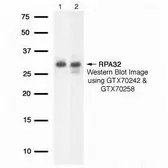 Anti-RPA32 antibody used in Western Blot (WB). GTX70242