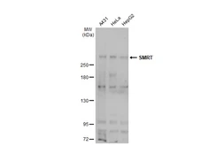 Anti-SMRT antibody used in Western Blot (WB). GTX70245