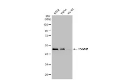 Anti-TSG101 antibody [4A10] used in Western Blot (WB). GTX70255