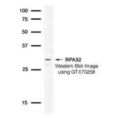 Anti-RPA32 antibody used in Western Blot (WB). GTX70258