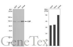 Anti-CtIP antibody [19E8] used in Western Blot (WB). GTX70264