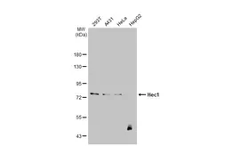 Anti-Hec1 antibody [9G3.23] used in Western Blot (WB). GTX70268