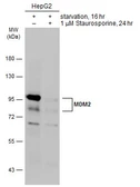 Anti-MDM2 antibody [SMP14] used in Western Blot (WB). GTX70278