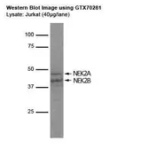 Anti-NEK2 antibody [1B6] used in Western Blot (WB). GTX70281