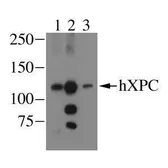 Anti-XPC antibody [3.26] used in Western Blot (WB). GTX70294