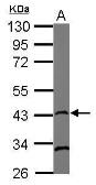 Anti-Rad51 antibody [13E4] used in Western Blot (WB). GTX70296
