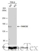 Anti-FANCD2 antibody [103] used in Western Blot (WB). GTX70299