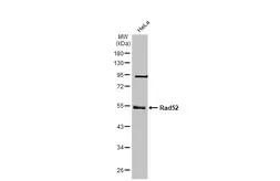 Anti-Rad52 antibody [5H9] used in Western Blot (WB). GTX70301