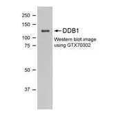 Anti-DDB1 antibody [1322] used in Western Blot (WB). GTX70302