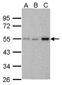 Anti-Chk1 antibody [6F5] used in Western Blot (WB). GTX70303