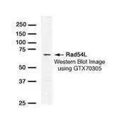 Anti-RAD54L antibody [38.4] used in Western Blot (WB). GTX70305