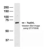 Anti-RAD54L antibody [60.1] used in Western Blot (WB). GTX70306