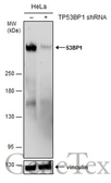Anti-53BP1 antibody used in Western Blot (WB). GTX70310