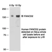 Anti-FANCD2 antibody [6] used in Western Blot (WB). GTX70314